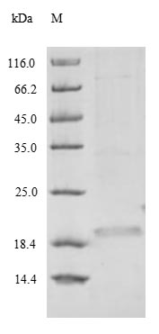 (Tris-Glycine gel) Discontinuous SDS-PAGE (reduced) with 5% enrichment gel and 15% separation gel. (Tris-Glycine gel) Discontinuous SDS-PAGE (reduced) with 5% enrichment gel and 15% separation gel.