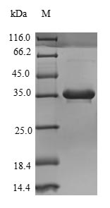 (Tris-Glycine gel) Discontinuous SDS-PAGE (reduced) with 5% enrichment gel and 15% separation gel. (Tris-Glycine gel) Discontinuous SDS-PAGE (reduced) with 5% enrichment gel and 15% separation gel.