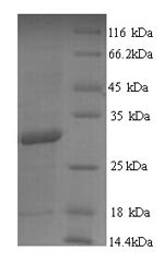 (Tris-Glycine gel) Discontinuous SDS-PAGE (reduced) with 5% enrichment gel and 15% separation gel. (Tris-Glycine gel) Discontinuous SDS-PAGE (reduced) with 5% enrichment gel and 15% separation gel.