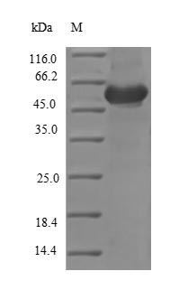 (Tris-Glycine gel) Discontinuous SDS-PAGE (reduced) with 5% enrichment gel and 15% separation gel. (Tris-Glycine gel) Discontinuous SDS-PAGE (reduced) with 5% enrichment gel and 15% separation gel.