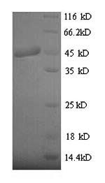 SDS-PAGE- Recombinant protein Clostridium botB