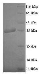 SDS-PAGE- Recombinant protein Epstein-Barr LMP1