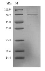 (Tris-Glycine gel) Discontinuous SDS-PAGE (reduced) with 5% enrichment gel and 15% separation gel. (Tris-Glycine gel) Discontinuous SDS-PAGE (reduced) with 5% enrichment gel and 15% separation gel.