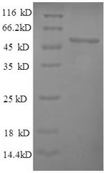 (Tris-Glycine gel) Discontinuous SDS-PAGE (reduced) with 5% enrichment gel and 15% separation gel.