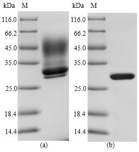 (Tris-Glycine gel) Discontinuous SDS-PAGE (reduced) with 5% enrichment gel and 15% separation gel. (Tris-Glycine gel) Discontinuous SDS-PAGE (reduced) with 5% enrichment gel and 15% separation gel.