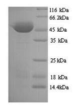 (Tris-Glycine gel) Discontinuous SDS-PAGE (reduced) with 5% enrichment gel and 15% separation gel. (Tris-Glycine gel) Discontinuous SDS-PAGE (reduced) with 5% enrichment gel and 15% separation gel.