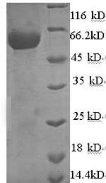 (Tris-Glycine gel) Discontinuous SDS-PAGE (reduced) with 5% enrichment gel and 15% separation gel. (Tris-Glycine gel) Discontinuous SDS-PAGE (reduced) with 5% enrichment gel and 15% separation gel.