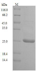 (Tris-Glycine gel) Discontinuous SDS-PAGE (reduced) with 5% enrichment gel and 15% separation gel. (Tris-Glycine gel) Discontinuous SDS-PAGE (reduced) with 5% enrichment gel and 15% separation gel.