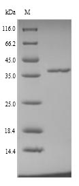 (Tris-Glycine gel) Discontinuous SDS-PAGE (reduced) with 5% enrichment gel and 15% separation gel. (Tris-Glycine gel) Discontinuous SDS-PAGE (reduced) with 5% enrichment gel and 15% separation gel.