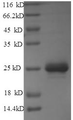 (Tris-Glycine gel) Discontinuous SDS-PAGE (reduced) with 5% enrichment gel and 15% separation gel. (Tris-Glycine gel) Discontinuous SDS-PAGE (reduced) with 5% enrichment gel and 15% separation gel.