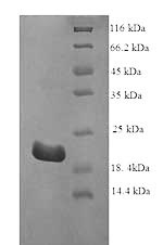 (Tris-Glycine gel) Discontinuous SDS-PAGE (reduced) with 5% enrichment gel and 15% separation gel. (Tris-Glycine gel) Discontinuous SDS-PAGE (reduced) with 5% enrichment gel and 15% separation gel.