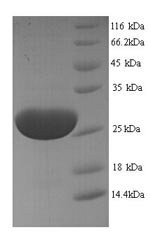 (Tris-Glycine gel) Discontinuous SDS-PAGE (reduced) with 5% enrichment gel and 15% separation gel. (Tris-Glycine gel) Discontinuous SDS-PAGE (reduced) with 5% enrichment gel and 15% separation gel.