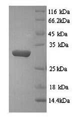 (Tris-Glycine gel) Discontinuous SDS-PAGE (reduced) with 5% enrichment gel and 15% separation gel. (Tris-Glycine gel) Discontinuous SDS-PAGE (reduced) with 5% enrichment gel and 15% separation gel.