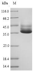 (Tris-Glycine gel) Discontinuous SDS-PAGE (reduced) with 5% enrichment gel and 15% separation gel.