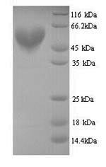 (Tris-Glycine gel) Discontinuous SDS-PAGE (reduced) with 5% enrichment gel and 15% separation gel. (Tris-Glycine gel) Discontinuous SDS-PAGE (reduced) with 5% enrichment gel and 15% separation gel.