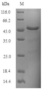 (Tris-Glycine gel) Discontinuous SDS-PAGE (reduced) with 5% enrichment gel and 15% separation gel. (Tris-Glycine gel) Discontinuous SDS-PAGE (reduced) with 5% enrichment gel and 15% separation gel.