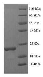 (Tris-Glycine gel) Discontinuous SDS-PAGE (reduced) with 5% enrichment gel and 15% separation gel. (Tris-Glycine gel) Discontinuous SDS-PAGE (reduced) with 5% enrichment gel and 15% separation gel.