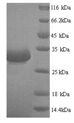 (Tris-Glycine gel) Discontinuous SDS-PAGE (reduced) with 5% enrichment gel and 15% separation gel. (Tris-Glycine gel) Discontinuous SDS-PAGE (reduced) with 5% enrichment gel and 15% separation gel.