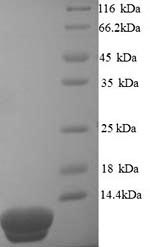 (Tris-Glycine gel) Discontinuous SDS-PAGE (reduced) with 5% enrichment gel and 15% separation gel. (Tris-Glycine gel) Discontinuous SDS-PAGE (reduced) with 5% enrichment gel and 15% separation gel.