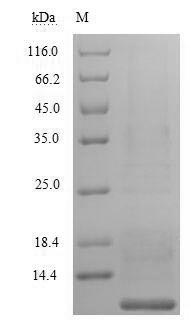 (Tris-Glycine gel) Discontinuous SDS-PAGE (reduced) with 5% enrichment gel and 15% separation gel. (Tris-Glycine gel) Discontinuous SDS-PAGE (reduced) with 5% enrichment gel and 15% separation gel.