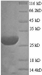 (Tris-Glycine gel) Discontinuous SDS-PAGE (reduced) with 5% enrichment gel and 15% separation gel. (Tris-Glycine gel) Discontinuous SDS-PAGE (reduced) with 5% enrichment gel and 15% separation gel.