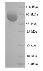 (Tris-Glycine gel) Discontinuous SDS-PAGE (reduced) with 5% enrichment gel and 15% separation gel. (Tris-Glycine gel) Discontinuous SDS-PAGE (reduced) with 5% enrichment gel and 15% separation gel.