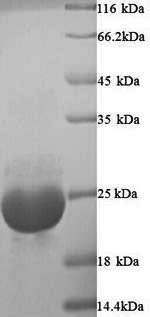 (Tris-Glycine gel) Discontinuous SDS-PAGE (reduced) with 5% enrichment gel and 15% separation gel. (Tris-Glycine gel) Discontinuous SDS-PAGE (reduced) with 5% enrichment gel and 15% separation gel.