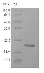 (Tris-Glycine gel) Discontinuous SDS-PAGE (reduced) with 5% enrichment gel and 15% separation gel. (Tris-Glycine gel) Discontinuous SDS-PAGE (reduced) with 5% enrichment gel and 15% separation gel.