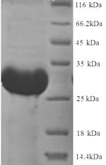(Tris-Glycine gel) Discontinuous SDS-PAGE (reduced) with 5% enrichment gel and 15% separation gel. (Tris-Glycine gel) Discontinuous SDS-PAGE (reduced) with 5% enrichment gel and 15% separation gel.
