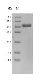(Tris-Glycine gel) Discontinuous SDS-PAGE (reduced) with 5% enrichment gel and 15% separation gel. (Tris-Glycine gel) Discontinuous SDS-PAGE (reduced) with 5% enrichment gel and 15% separation gel.