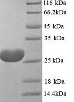(Tris-Glycine gel) Discontinuous SDS-PAGE (reduced) with 5% enrichment gel and 15% separation gel. (Tris-Glycine gel) Discontinuous SDS-PAGE (reduced) with 5% enrichment gel and 15% separation gel.