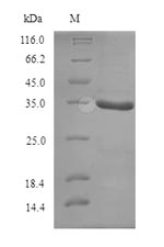 (Tris-Glycine gel) Discontinuous SDS-PAGE (reduced) with 5% enrichment gel and 15% separation gel. (Tris-Glycine gel) Discontinuous SDS-PAGE (reduced) with 5% enrichment gel and 15% separation gel.