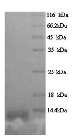 (Tris-Glycine gel) Discontinuous SDS-PAGE (reduced) with 5% enrichment gel and 15% separation gel. (Tris-Glycine gel) Discontinuous SDS-PAGE (reduced) with 5% enrichment gel and 15% separation gel.