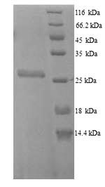 (Tris-Glycine gel) Discontinuous SDS-PAGE (reduced) with 5% enrichment gel and 15% separation gel. (Tris-Glycine gel) Discontinuous SDS-PAGE (reduced) with 5% enrichment gel and 15% separation gel.