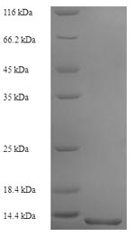 (Tris-Glycine gel) Discontinuous SDS-PAGE (reduced) with 5% enrichment gel and 15% separation gel.