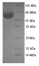 (Tris-Glycine gel) Discontinuous SDS-PAGE (reduced) with 5% enrichment gel and 15% separation gel. (Tris-Glycine gel) Discontinuous SDS-PAGE (reduced) with 5% enrichment gel and 15% separation gel.