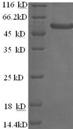 (Tris-Glycine gel) Discontinuous SDS-PAGE (reduced) with 5% enrichment gel and 15% separation gel. (Tris-Glycine gel) Discontinuous SDS-PAGE (reduced) with 5% enrichment gel and 15% separation gel.