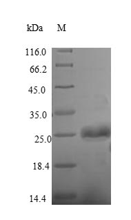 (Tris-Glycine gel) Discontinuous SDS-PAGE (reduced) with 5% enrichment gel and 15% separation gel. (Tris-Glycine gel) Discontinuous SDS-PAGE (reduced) with 5% enrichment gel and 15% separation gel.