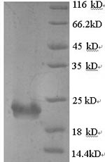 (Tris-Glycine gel) Discontinuous SDS-PAGE (reduced) with 5% enrichment gel and 15% separation gel. (Tris-Glycine gel) Discontinuous SDS-PAGE (reduced) with 5% enrichment gel and 15% separation gel.