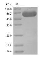 (Tris-Glycine gel) Discontinuous SDS-PAGE (reduced) with 5% enrichment gel and 15% separation gel. (Tris-Glycine gel) Discontinuous SDS-PAGE (reduced) with 5% enrichment gel and 15% separation gel.