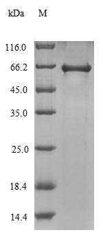 (Tris-Glycine gel) Discontinuous SDS-PAGE (reduced) with 5% enrichment gel and 15% separation gel. (Tris-Glycine gel) Discontinuous SDS-PAGE (reduced) with 5% enrichment gel and 15% separation gel.
