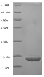 (Tris-Glycine gel) Discontinuous SDS-PAGE (reduced) with 5% enrichment gel and 15% separation gel. (Tris-Glycine gel) Discontinuous SDS-PAGE (reduced) with 5% enrichment gel and 15% separation gel.