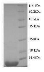 (Tris-Glycine gel) Discontinuous SDS-PAGE (reduced) with 5% enrichment gel and 15% separation gel. (Tris-Glycine gel) Discontinuous SDS-PAGE (reduced) with 5% enrichment gel and 15% separation gel.