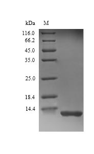 (Tris-Glycine gel) Discontinuous SDS-PAGE (reduced) with 5% enrichment gel and 15% separation gel. (Tris-Glycine gel) Discontinuous SDS-PAGE (reduced) with 5% enrichment gel and 15% separation gel.