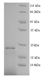 (Tris-Glycine gel) Discontinuous SDS-PAGE (reduced) with 5% enrichment gel and 15% separation gel. (Tris-Glycine gel) Discontinuous SDS-PAGE (reduced) with 5% enrichment gel and 15% separation gel.