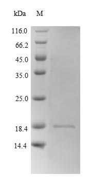(Tris-Glycine gel) Discontinuous SDS-PAGE (reduced) with 5% enrichment gel and 15% separation gel. (Tris-Glycine gel) Discontinuous SDS-PAGE (reduced) with 5% enrichment gel and 15% separation gel.