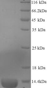 (Tris-Glycine gel) Discontinuous SDS-PAGE (reduced) with 5% enrichment gel and 15% separation gel. (Tris-Glycine gel) Discontinuous SDS-PAGE (reduced) with 5% enrichment gel and 15% separation gel.