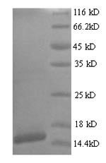 CSB-YP361948HMN SDS-PAGE