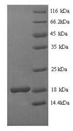 (Tris-Glycine gel) Discontinuous SDS-PAGE (reduced) with 5% enrichment gel and 15% separation gel. (Tris-Glycine gel) Discontinuous SDS-PAGE (reduced) with 5% enrichment gel and 15% separation gel.
