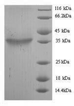 (Tris-Glycine gel) Discontinuous SDS-PAGE (reduced) with 5% enrichment gel and 15% separation gel. (Tris-Glycine gel) Discontinuous SDS-PAGE (reduced) with 5% enrichment gel and 15% separation gel.